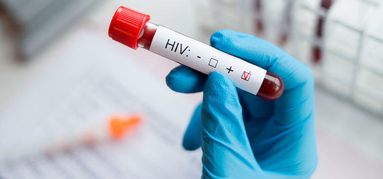 Hablando de VIH: “Indetectable = Intransmisible (I=I)”